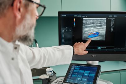 Reoperace křečových žil: Opravíme, co se jinde nepovedlo