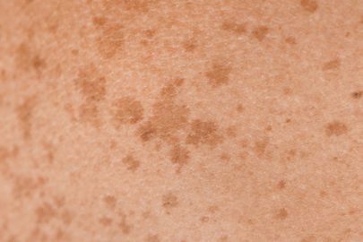 Pihy: Přehled, projevy a možná nebezpečí