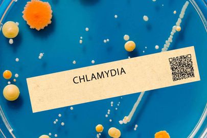 Chlamydie: nejčastější skrytá infekce. Jak ji diagnostikujeme?