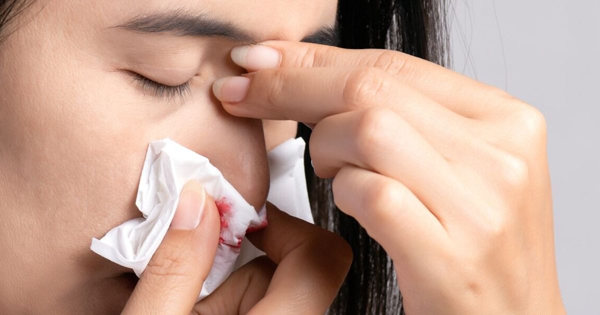 Krvácení Z Nosu Dokáže Potrápit V Každém Věku Klinika Komplexní Péče 8420