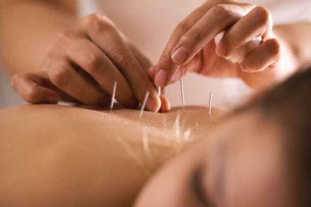 Akupunktura rozšiřuje možnosti klasické medicíny